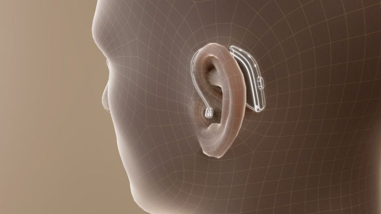 İşitme Kaybı Belirtileri Nelerdir? Ne Zaman İşitme Cihazı Gerekir?